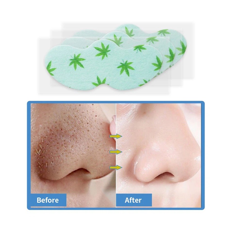 nose pore strip (14)
